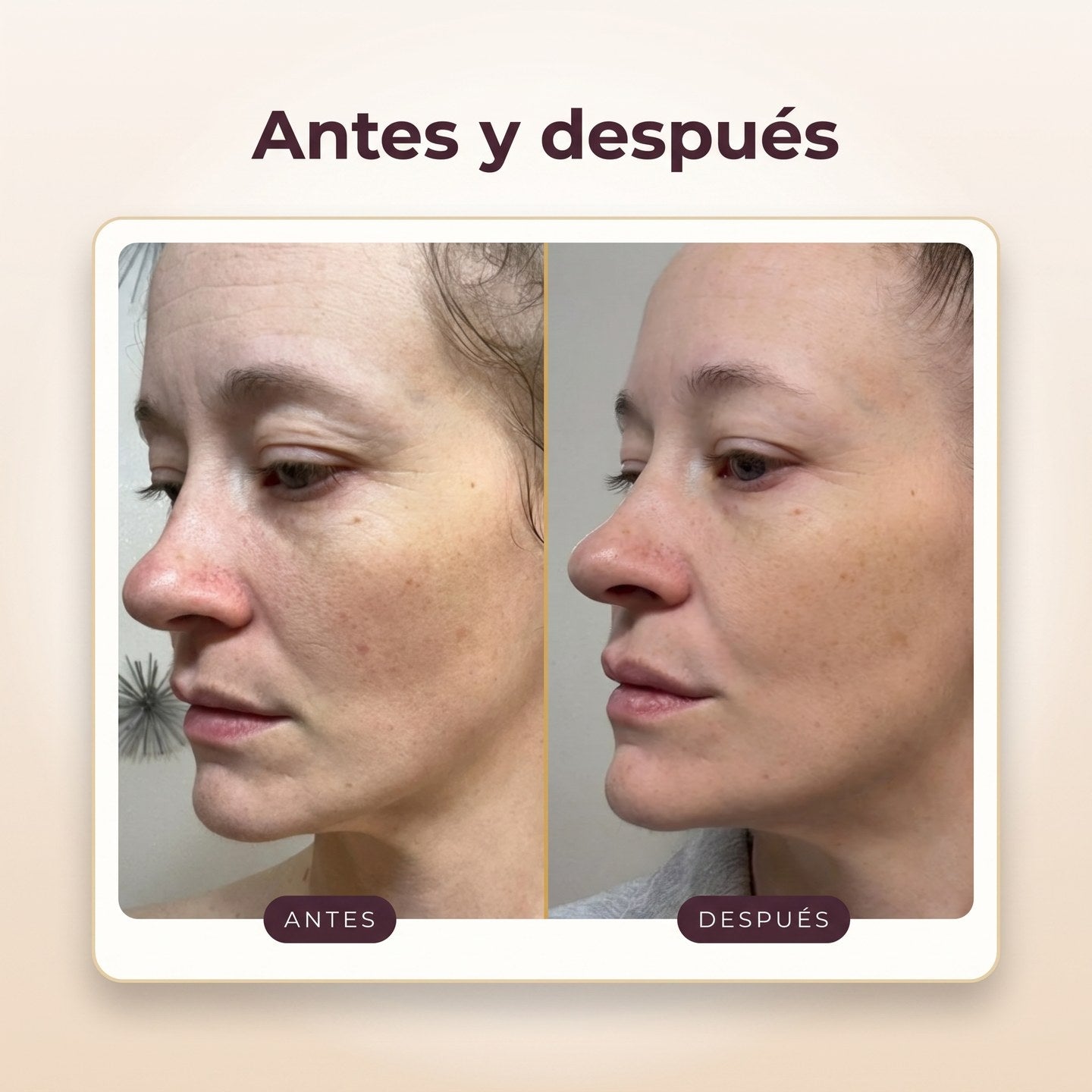 Antes y después